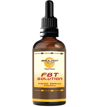 FBT Solution