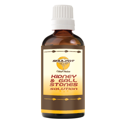 Kidney and Gall Stones Solution